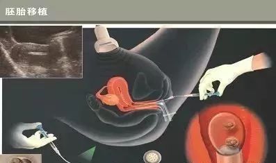 供卵代生医院代生包成功